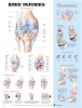 Anatomical Poster - Knee Injuries
